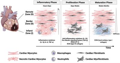 Engineering the Cellular Microenvironment of Post-infarct Myocardium on a Chip